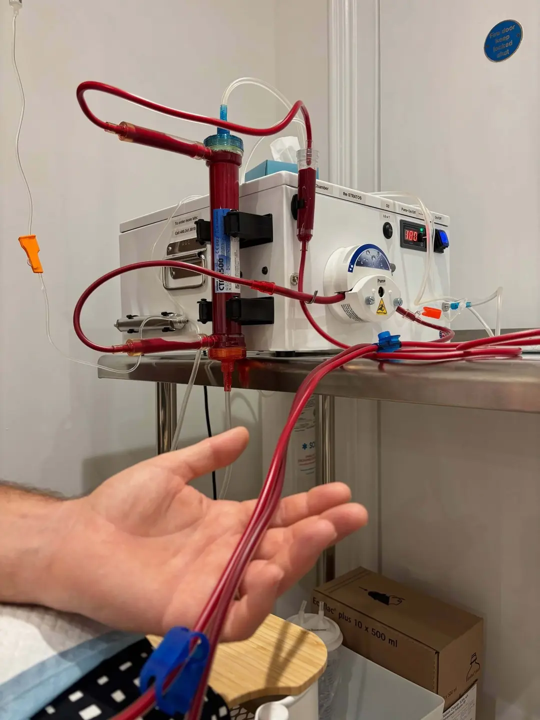 Máquina de hemodiálisis en funcionamiento
